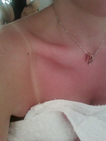 Sick ass tan lines