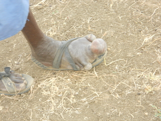a little elephantiasis never hurt anyone....saw this guy yesterday